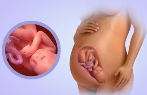 Hầu hết thai nhi 40 tuần tuổi đều chào đời với cái đầu méo