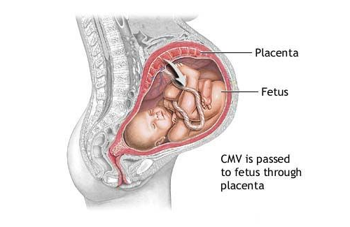 Phòng tránh nhiễm khuẩn thai nhi để bảo vệ bé ngay từ trong bụng mẹ