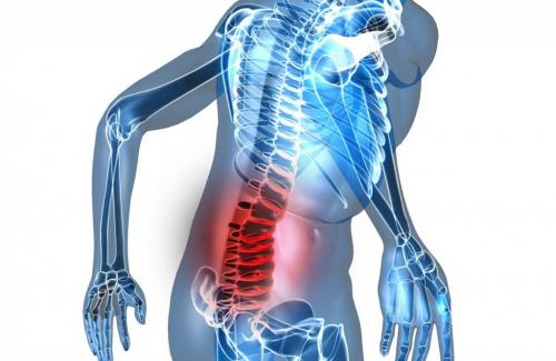 Bài thuốc trị bệnh đau lưng hiệu quả tùy theo từng thể bệnh khác nhau