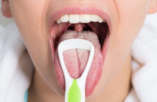 Bạn có biết: Không làm sạch lưỡi khi đánh răng nguy hiểm thế nào?