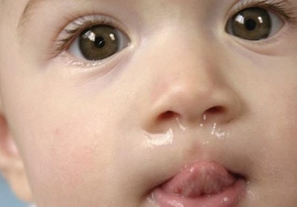 Bật mí cách trị sổ mũi cho bé hiệu quả không cần dùng thuốc