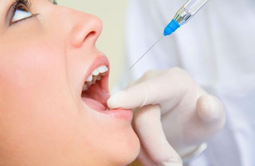 Chữa tủy răng như thế nà? Nguyên nhân và hiệu quả của việc lấy tủy răng