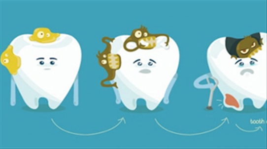 4 thói quen nhiều người mắc phải khiến răng ngày càng hỏng nặng