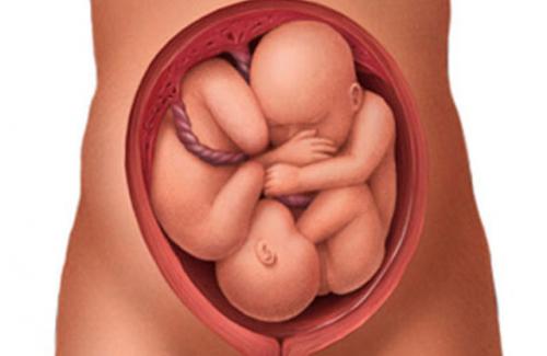 Ngôi thai ngược là gì? Nguyên nhân và cách xử lý tình trạng ngôi thai ngược