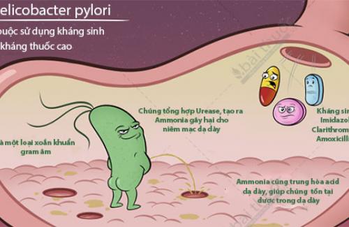 Lưu ý cực quan trọng khi dùng thuốc diệt H.Pylori ở dạ dày