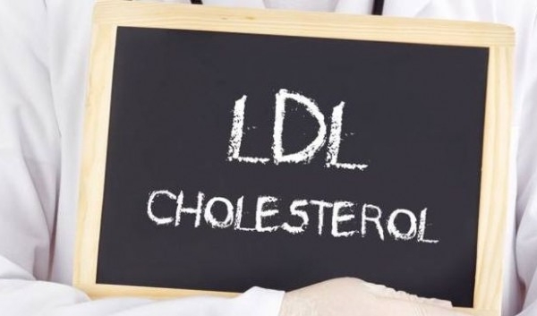 Vì sao nên kiểm tra cholesterol thường xuyên sau cơn đau tim?
