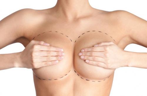 5 lý do chủ yếu khiến phái nữ nên tháo bỏ túi nâng ngực
