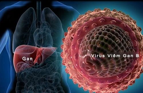 Nhiễm vi-rút viêm gan siêu vi B có đáng lo hay không?