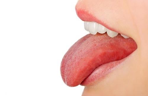 Rêu lưỡi trắng là sao? Nguyên nhân và cách điều trị hiệu quả