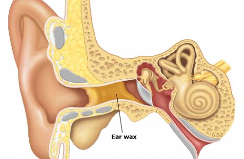 Ráy tai là gì? Những ảnh hưởng do ráy tai gây ra đối với sức khỏe