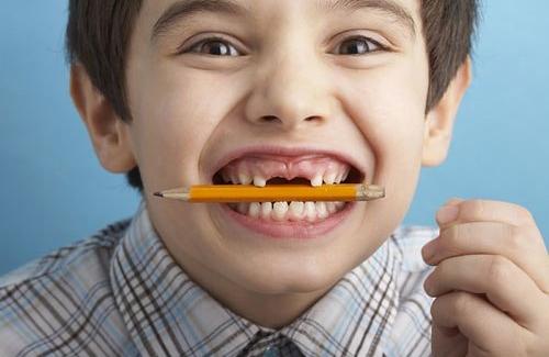 Chấn thương răng ở trẻ em và một số biện pháp khắc phục