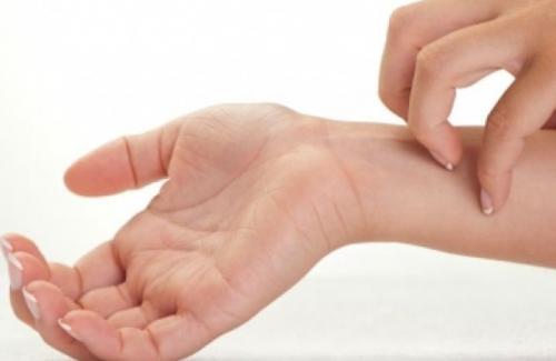 Tróc da tay là bệnh gì? Cách chữa trị bong tróc da tay đơn giản