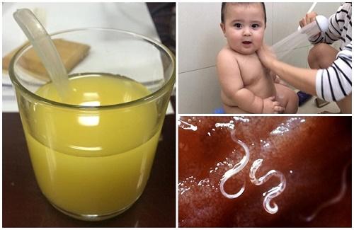Nhờ cốc nước tự làm mẹ TỐNG HẾT giun sán, LỌC SẠCH ruột cho con giúp bé ăn ngoan ngủ tốt