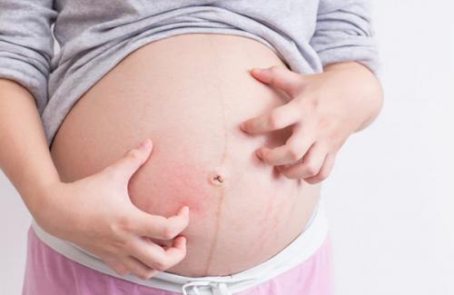 Bị dị ứng khi mang thai 3 tháng đầu có nguy hiểm không?