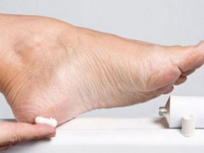 Cách khắc phục vết chai sần ở chân không phải ai cũng biết