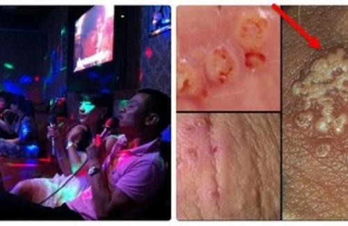 Đã tìm ra loại vi khuẩn chứa ĐỘC TÍNH cực mạnh trong micro chúng ta hát karaoke mà hàng triệu người Việt không hề hay biết