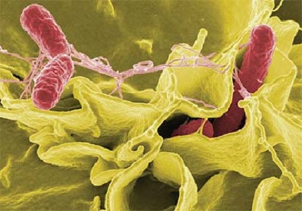 Nhận biết vi khuẩn ăn ruột cực nguy hiểm có thể bạn chưa biết