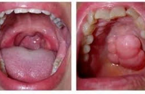 Khoang miệng là gì? Cấu tạo và chức năng của khoang miệng