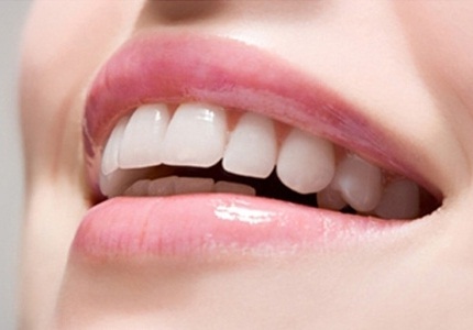 Cách làm trắng răng đơn giản, an toàn lại hiệu quả cao