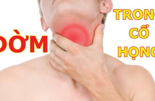 Đờm ở cổ họng là gì? Nguyên nhân gây đờm dãi ở cổ họng và cách điều trị