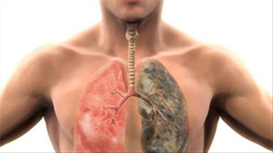 Thanh lọc sạch mọi độc tố tích tụ trong phổi với 6 bước đơn giản ai cũng làm được
