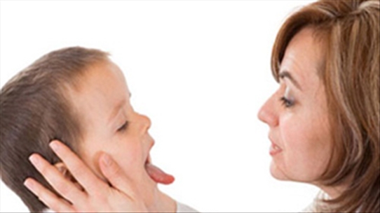 4 cách phòng và điều trị các bệnh ở miệng của trẻ em