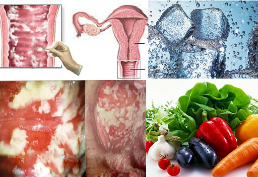 Đây là top 7 thực phẩm nên ăn hàng này giúp cả đời tránh ung thư tử cung và vùng nhạy cảm luôn khỏe mạnh thơm tho