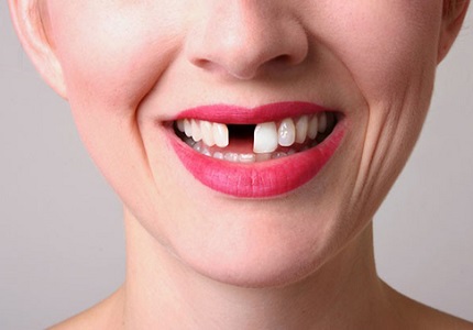 10 thói quen xấu vô tình khiến răng bạn bị tổn thương