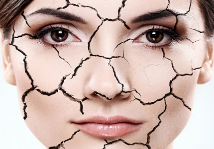 Vạch mặt một số bệnh ảnh hưởng lớn tới làn da của bạn