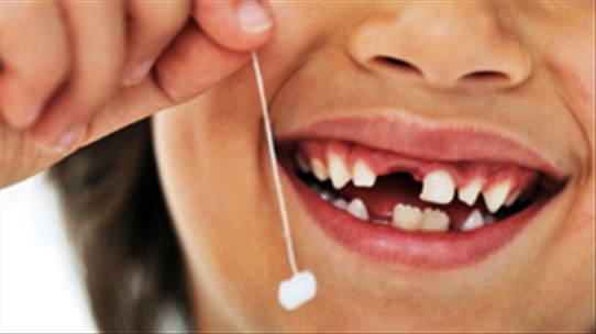 Tiềm ẩn nguy hại khi nhổ răng sữa sớm cho trẻ mẹ nên biết
