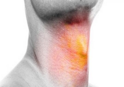 Vạch trần 5 nguyên nhân phổ biến nhất gây ung thư họng