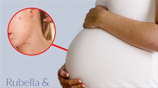 Những nguy hiểm với thai nhi khi mẹ bầu bị mắc Rubella