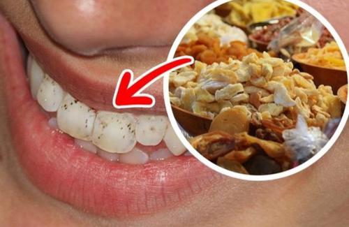Thực phẩm ăn vào khiến răng rụng sớm 10 năm nên bỏ ngay lập tức