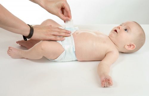 Chăm sóc rốn cho trẻ sơ sinh như thế nào là hiệu quả nhất?