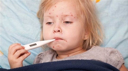 Chăm sóc trẻ sốt phát ban tại nhà thế nào cho con nhanh khỏi
