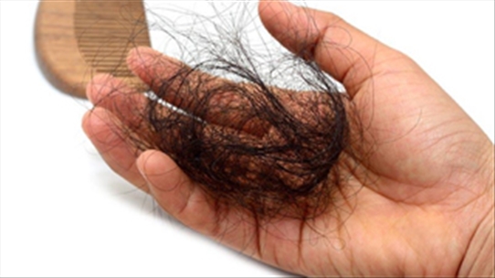 Khám phá nguyên nhân khiến cho người trẻ ngày càng bị rụng tóc