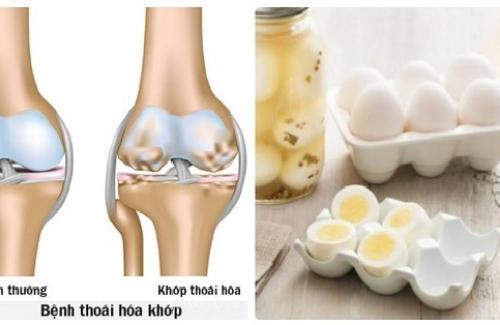 Chỉ với 1 quả trứng gà mà người Nhật đã làm cách này để cả đời họ không bao giờ bị đau khớp, viêm khớp nữa!