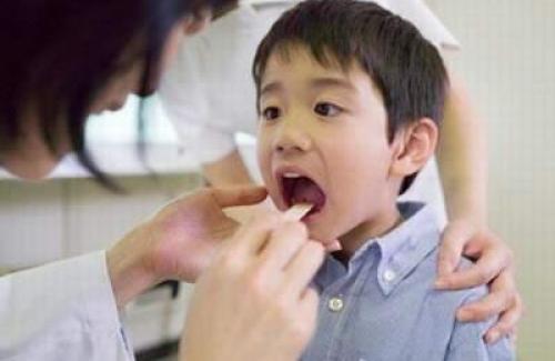 Viêm họng là bệnh rất hay gặp vào mùa lạnh ở trẻ em