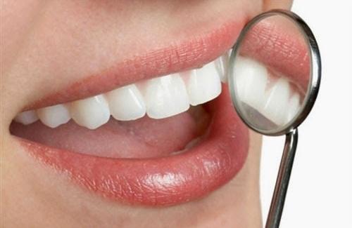 Giật mình với 6 lý do khiến bạn có vấn đề về nướu răng