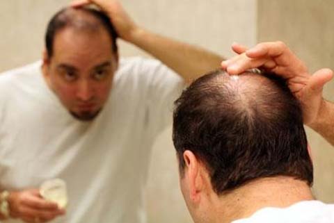Nguyên nhân gây ra chứng rụng tóc-giải pháp khác phục