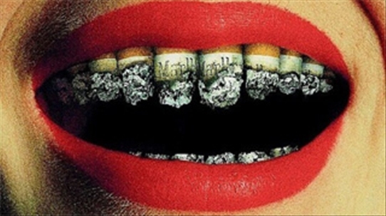 Bệnh về răng miệng do thuốc lá gây ra mà bạn nên biết