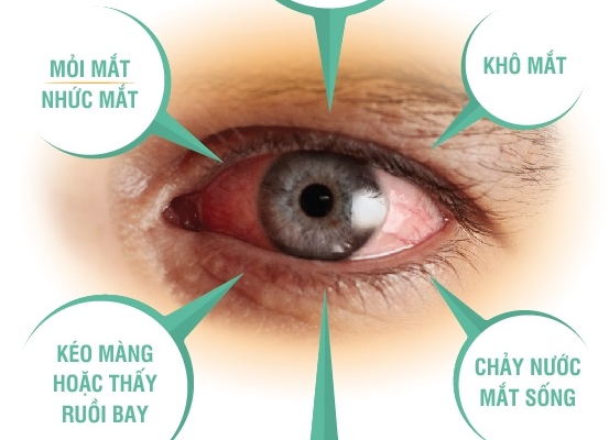 Suy giảm thị lực vì mắt “già” trước tuổi- giải pháp khắc phục
