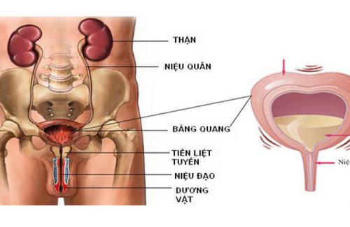 Những kiến thức cơ bản về bệnh ung thư bàng quang bạn nên biết