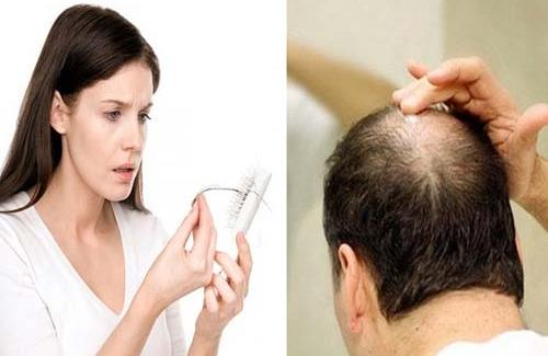 Sử dụng thuốc chữa viêm khớp liệu có chữa được chứng bệnh rụng tóc?