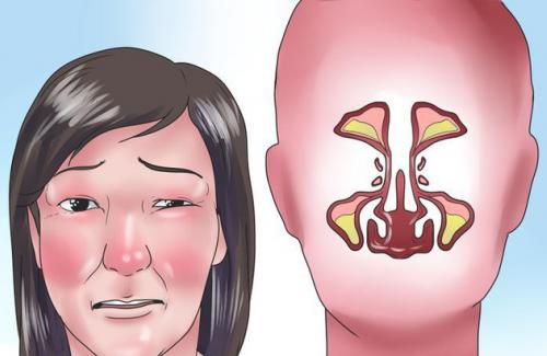Đông y điều trị nghẹt mũi mà không phải ai cũng biết đến