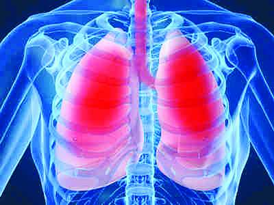 Sau mụn nhọt dễ viêm phổi tụ cầu, cần có những biện pháp phòng tránh