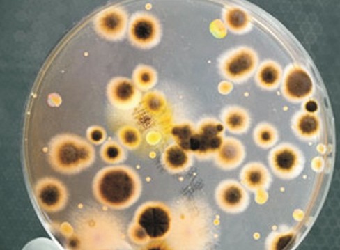 Phòng ngừa viêm phổi do nhiễm vi khuẩn Legionella để bệnh không gây nguy hại