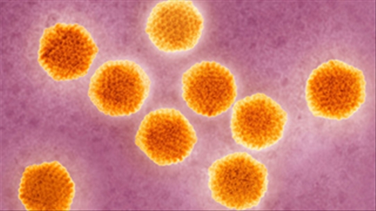 Viêm gan siêu vi A có thể gây dịch và tử vong do suy gan cấp