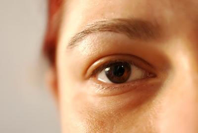 Triệu chứng của zona mắt nguyên tắc phòng và điều trị