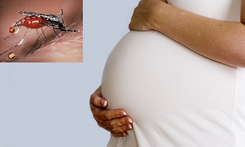 Cảnh báo nguy cơ dễ sảy thai ở thai phụ bị bệnh sốt rét